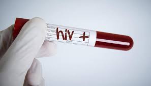 Evrensel Hasta Hakları Derneği, Pozitif Düşün İnisiyatifi:HIV ile ilgili yetersiz bilgi HIV ile yaşayanların damgalanmasına ve dışlanmasına neden oluyor