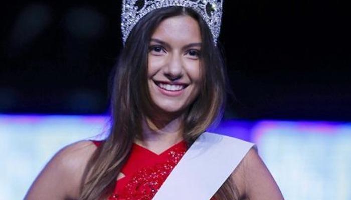 Miss Turkey Güzeli Buse İskenderoğlu üstsüz poz verdi! Eliyle kapadı, sosyal medya yıkıldı
