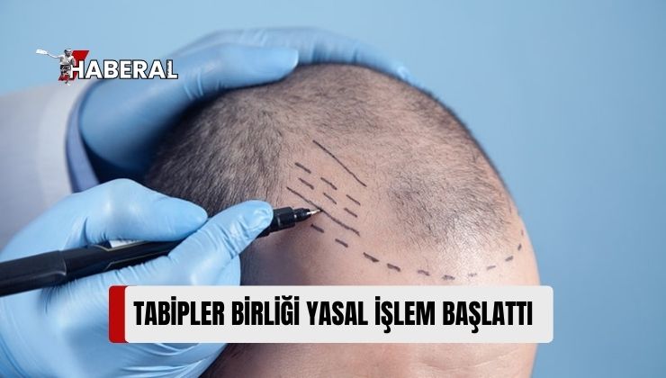 Tabipler Birliği: Çalışma İzni Olmadan Saç Ekimi Yapanlar Tespit Edildi