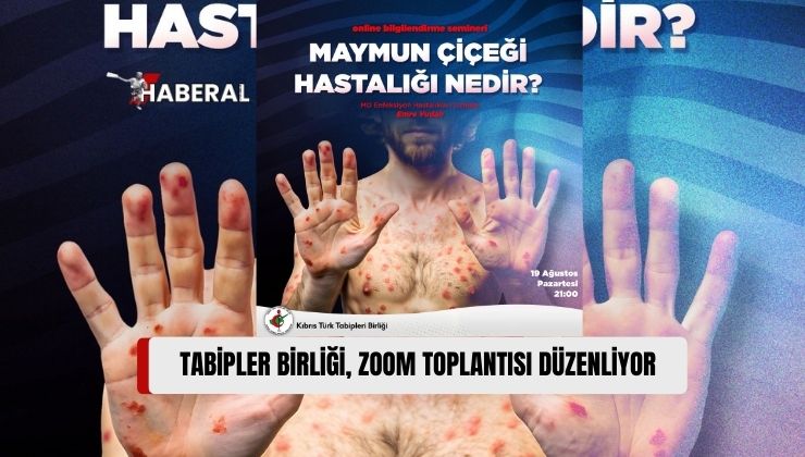 Tabipler Birliği, Maymun Çiçeği Hastalığına İlişkin Zoom Toplantısı Düzenleyecek