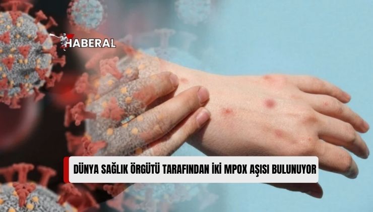 Türk Mikrobiyoloji Cemiyeti – KKTC Mikrobiyoloji Platformu, Maymun Çiçeği Konusunda Uyarılarda Bulundu