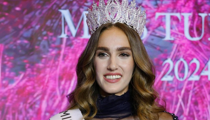 Estetik mi yaptırdı? Miss Turkey birincisi İdil Bilgen’in son hali kafaları karıştırdı! ‘Aynı kişi olduğuna…’