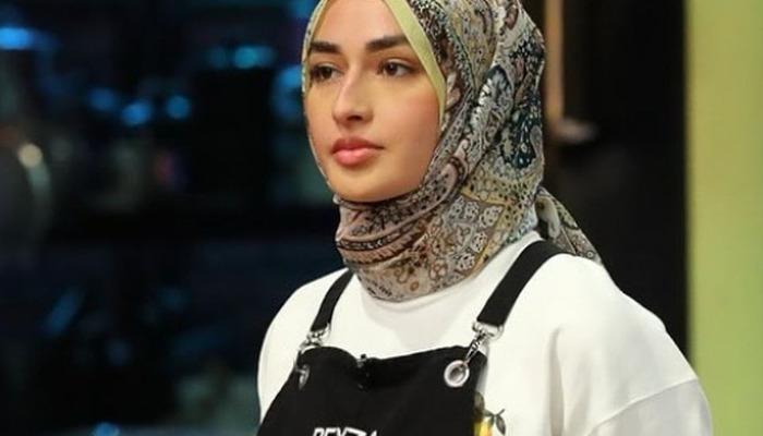 Somer Şef, Masterchef’te yüzü yanan Beyza’nın durumuyla ilgili konuştu!